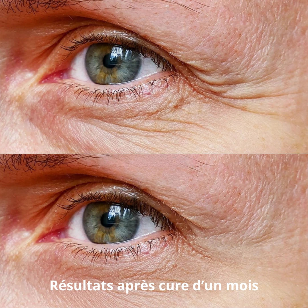Patchs Regard Micro-Infusion Anti-Âge