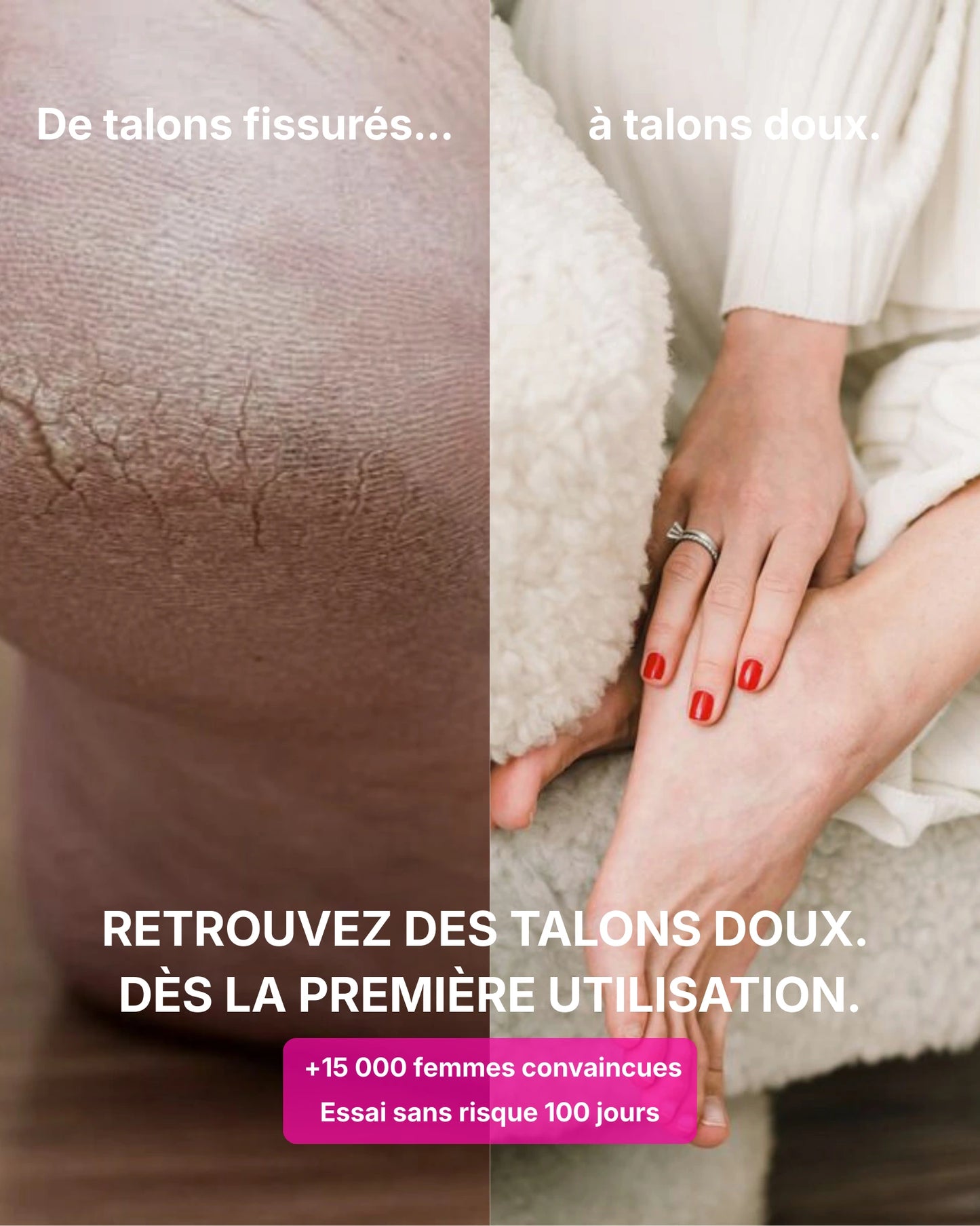 Nakura SoftSkin Pro™