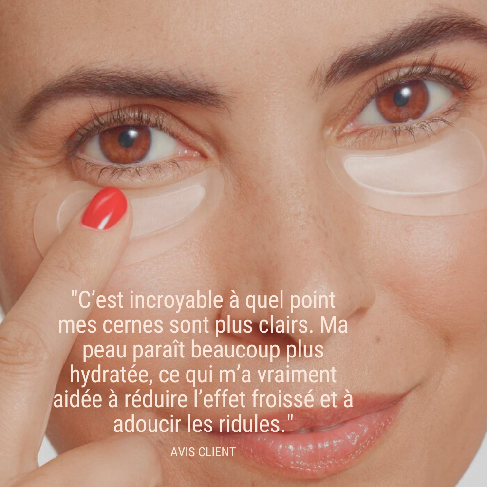 Patchs micro-needling Acide Hyaluronique - Anti rides et ridules