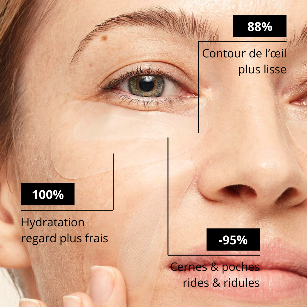 Patchs  micro-needling Acide Hyaluronique - Anti rides et ridules