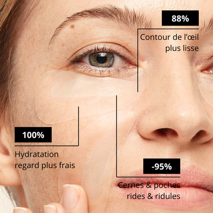 Patchs  micro-needling Acide Hyaluronique - Anti rides et ridules