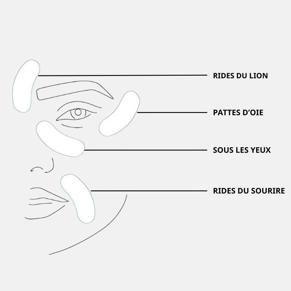 Patchs  micro-needling Acide Hyaluronique - Anti rides et ridules