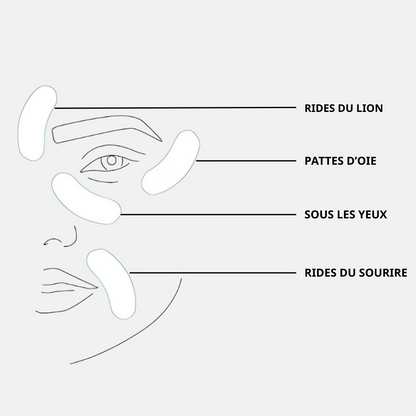 Patchs  micro-needling Acide Hyaluronique - Anti rides et ridules